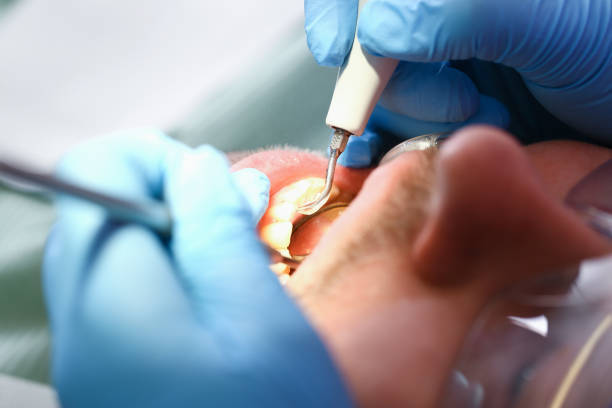 Best Dental Abscess Treatment in Ceredo, WV